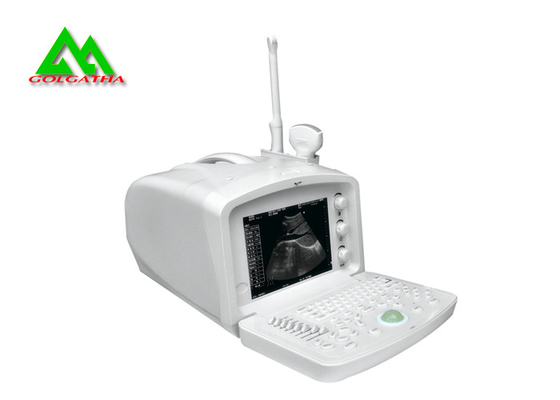 China Escáner humano del ultrasonido del equipo médico del ultrasonido de Digitaces con la exhibición del LCD proveedor