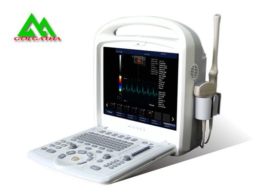 China Diseño portátil del ordenador portátil de Doppler del color del equipo médico del ultrasonido del hospital distribuidor